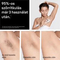 Braun Smart IPL Skin i-expert 7 Depilator PL7432 Akkus IPL Villanófényes Szőrtelenítő - Fehér