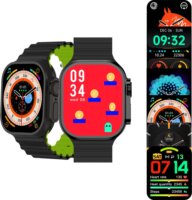 Media-tech Fusion MT872 Okosóra - Fekete