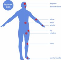 TensCare Perfect TENS Fájdalomcsillapító Izomstimuláló készülék