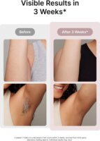 Ulike Air3 Hálózati IPL Villanófényes szőrtelenítő - Rózsaszín