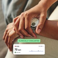 Withings ScanWatch 2 Okosóra 38mm - Fehér